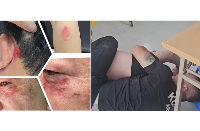 평택시, 이병진 국회의원 지역사무실서 기자 폭행 사건 …